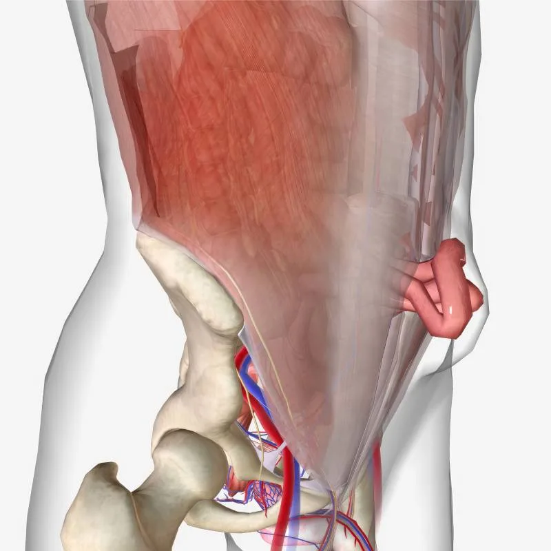 Anatomical model showing the complications of abdominal wall hernias