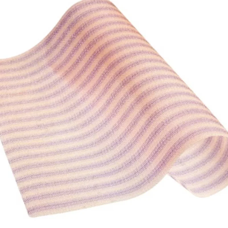 Large-pore mesh for reinforcing the abdominal wall